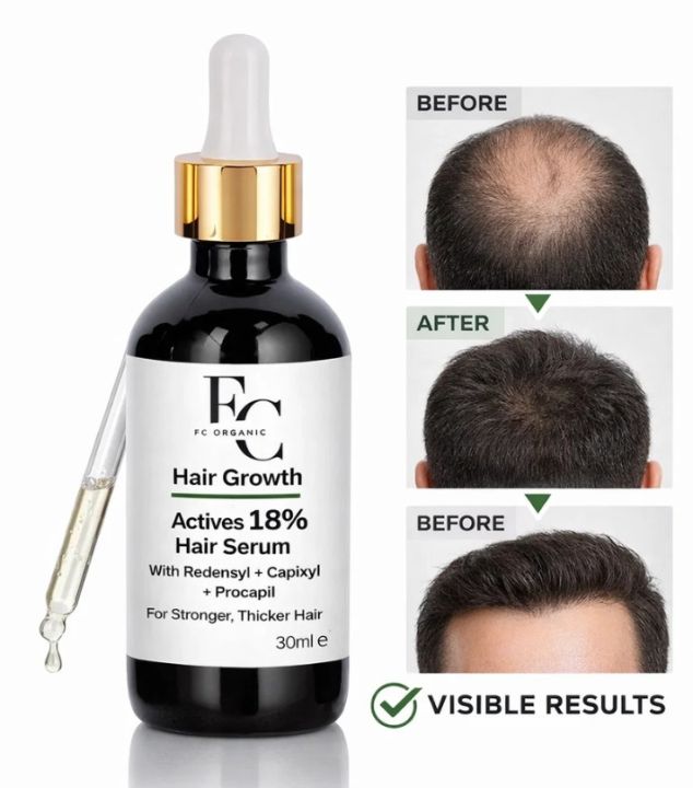 Herbal Hair Growth Serum 30ml